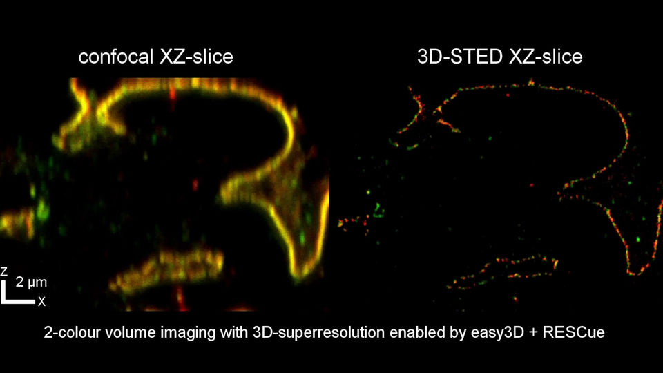 Two-color EASY3D RESCUE STED volume stack of a cleared adult rat kidney sample